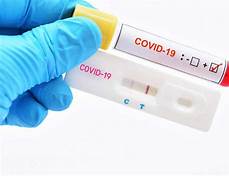 Извършено е изследване на педагогически и непедагогически персонал с бързи антигенни тестове срещу COVID-19 на територията на община Свищов